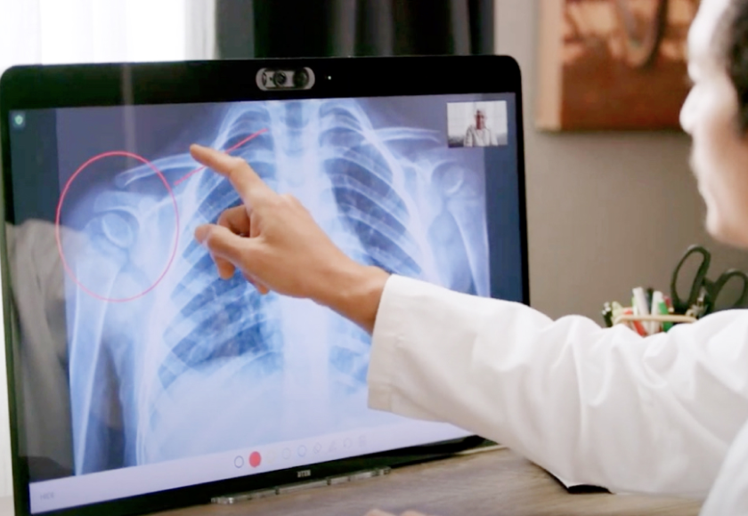 Virtuelle Röntgenberatung